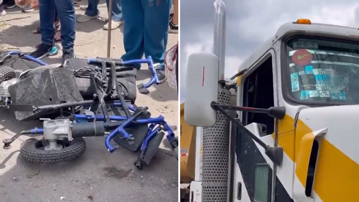 Camión de carga atropella a adulto mayor en silla de ruedas y le rompe ambas piernas