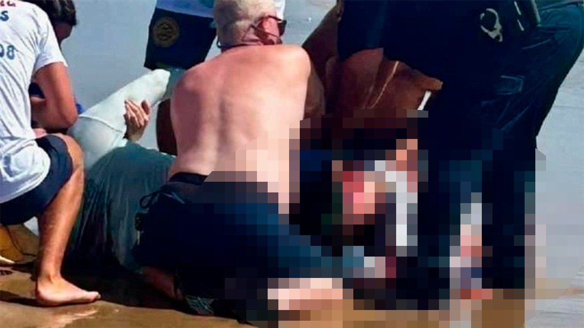 VIDEO Dos turistas sufrieron un ataque de tiburón en Isla del Padre en pleno festejo nacional