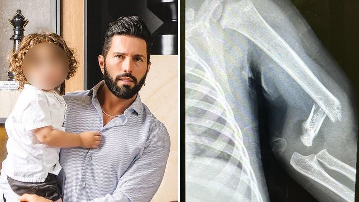 'Fue mi culpa': bebé de Poncho De Nigris se accidenta y se rompe el brazo