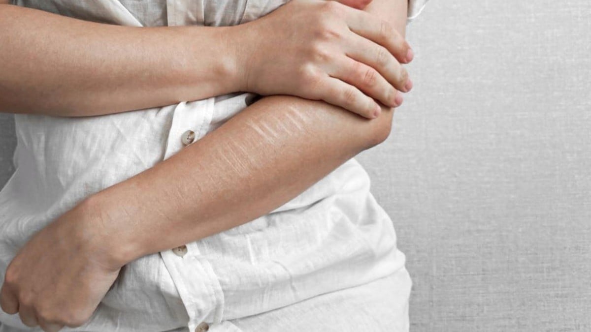 Alerta SSG sobre aumento de autolesiones en jóvenes