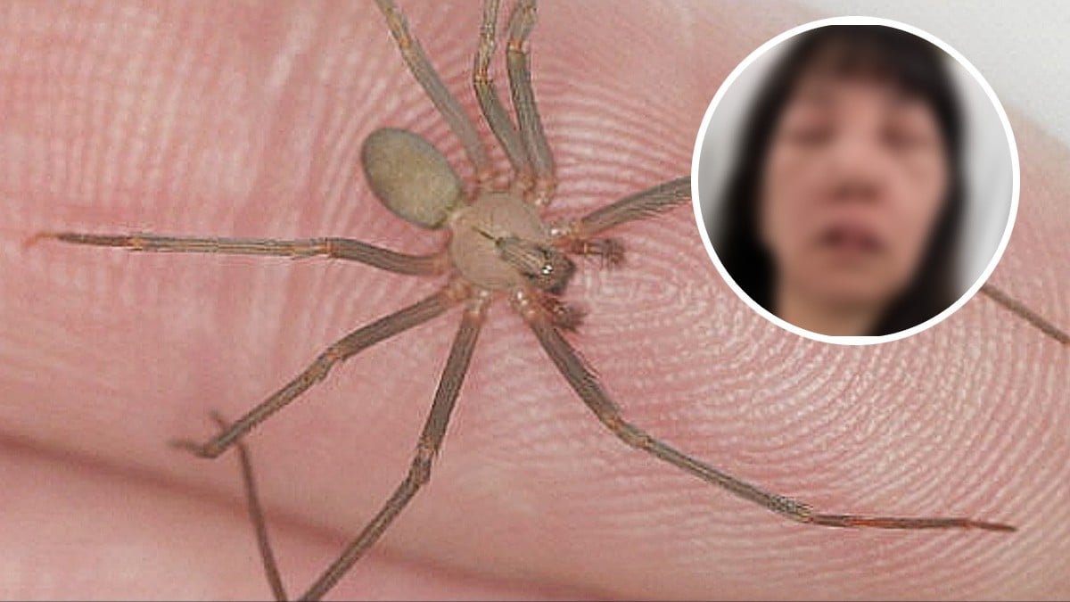 Mujer quitaba telaraña en su patio y de pronto arañas violinistas la picaron en la cara