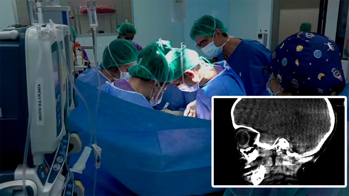 Niña acaba con una aguja en el cerebro durante una cita en el dentista y esto le hicieron