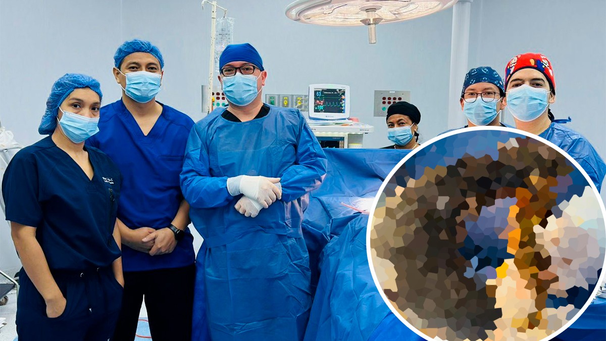 Mujer se quejó de dolores abdominales, doctores la revisan y le extraen esto del estómago