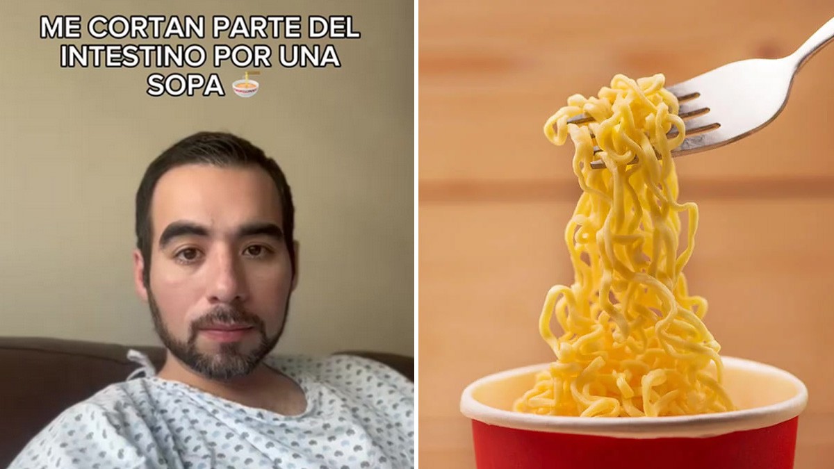 Joven comió una sopa y le tuvieron que cortar parte de su intestino