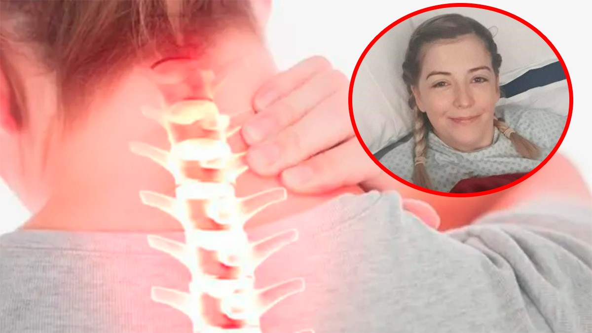Mujer se ‘tronó’ el cuello y sufrió un derrame cerebral, ¿es posible?