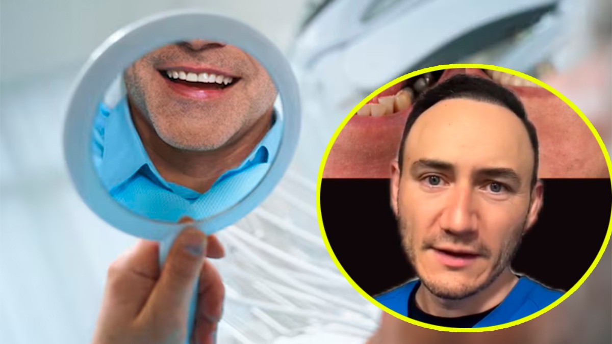 VIDEO Hombre fue al dentista y cuando se vio en el espejo rompió en llanto por esta razón