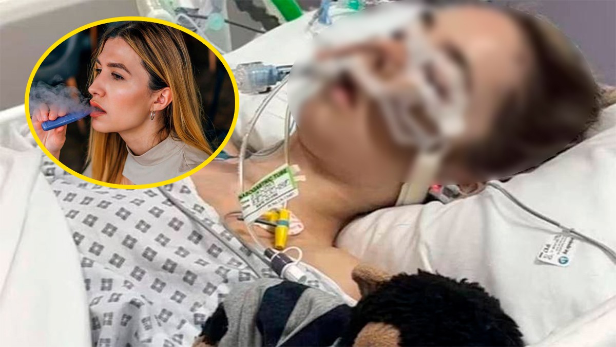 Compartir su vapeador con amigos llevó a un joven a contraer una infección mortal