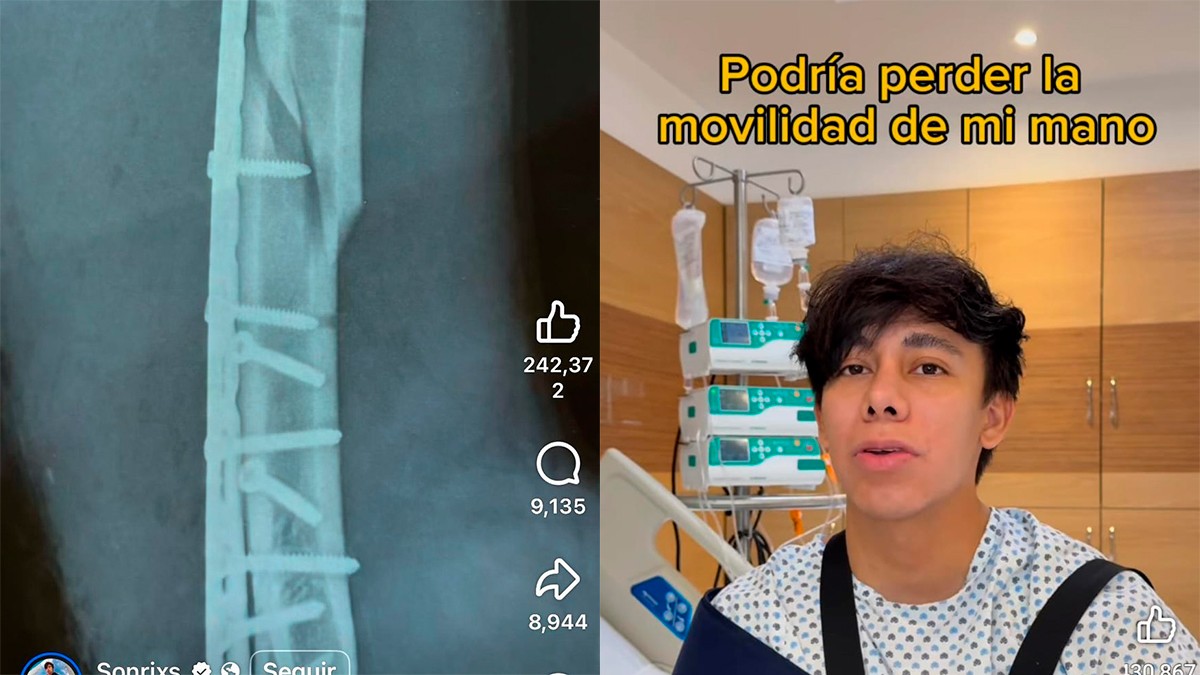 VIDEO Sonrixs revela cómo ocurrió el accidente que podría dejar su mano inmovilizada