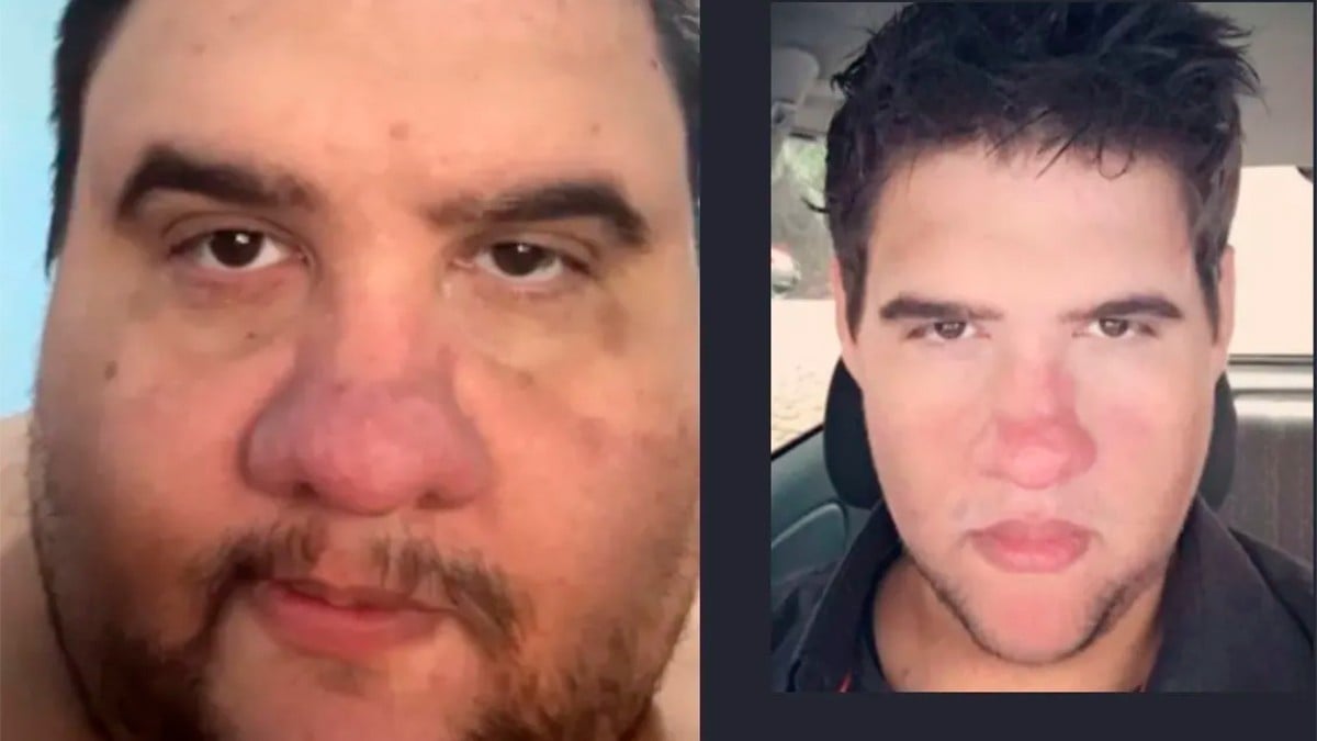 Influencer reconocido por perder 200 kilos muere mientras dormía; esto se sabe