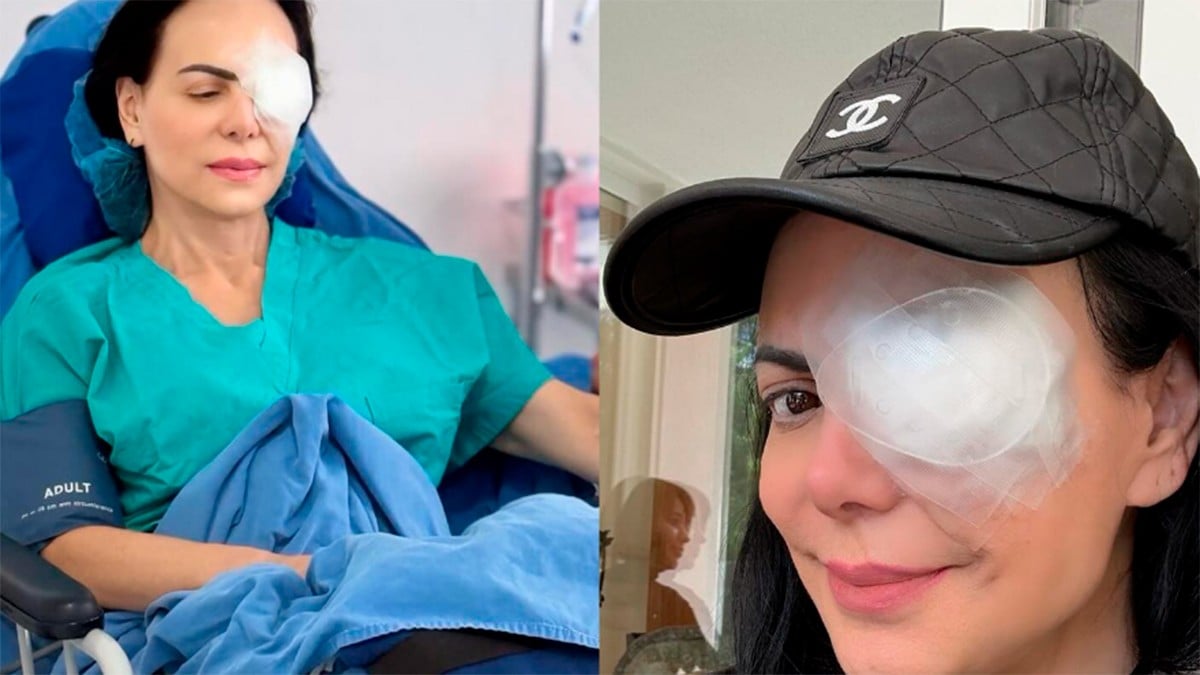 ¿Por qué Maribel Guardia lleva un parche en el ojo? Esto es lo que sabemos