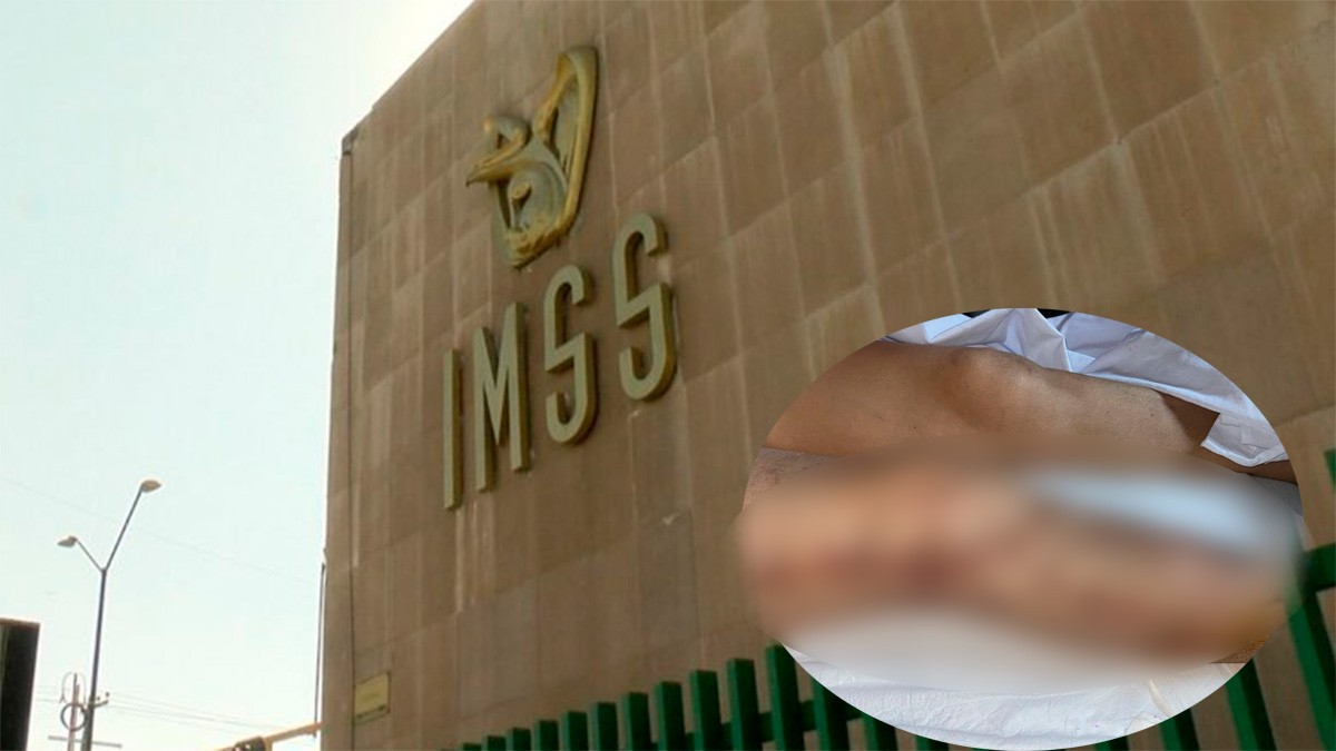 IMSS responde a denuncias de tardanza en cirugías en la clínica T-21