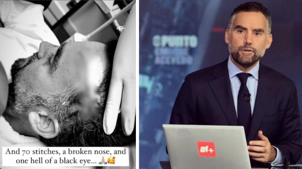 Este terrible accidente sufrió el periodista Enrique Acevedo