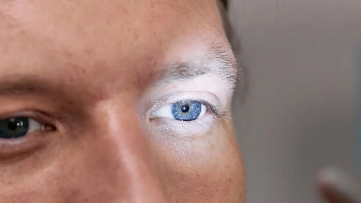 ¿Tomas alguno de estos medicamentos para bajar de peso? ¡Cuidado! Podrían causar ceguera