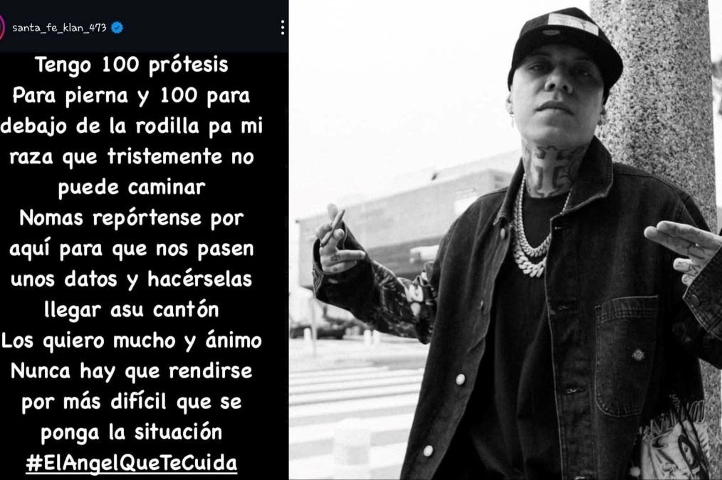 ¿Necesitas una prótesis? Apúrate, Santa Fe Klan tiene 200 para donar