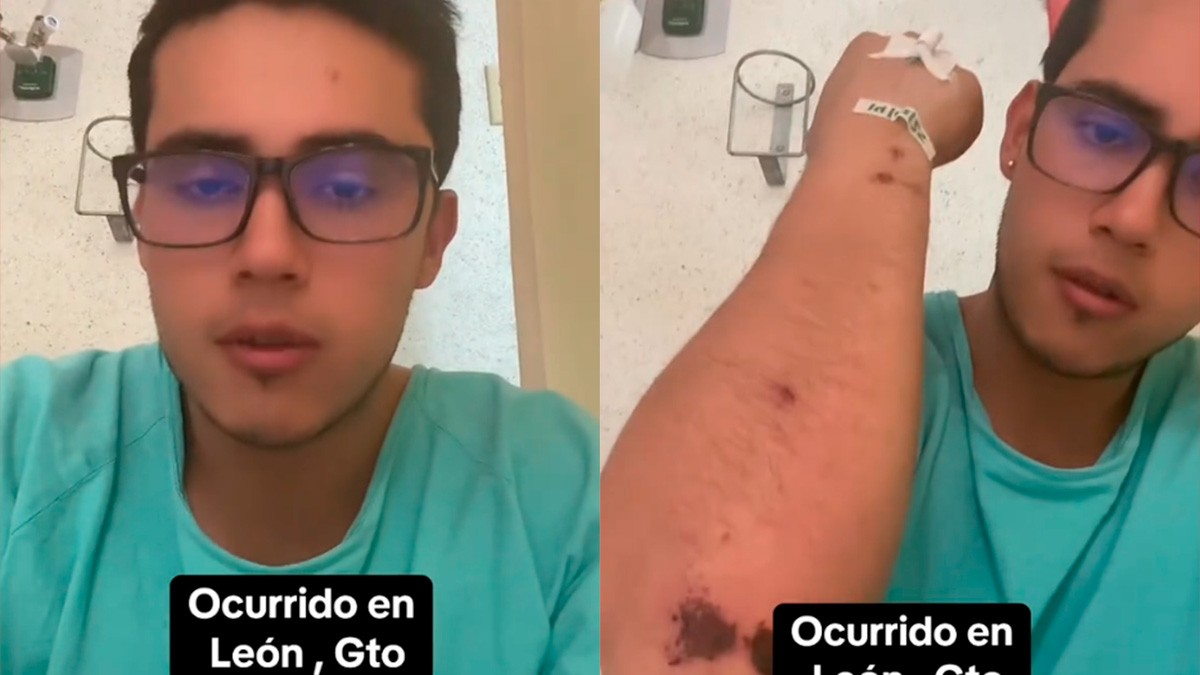 VIDEO “Me drogó y me golpeó“: Joven leonés relata cómo lo asaltaron al tomar un taxi