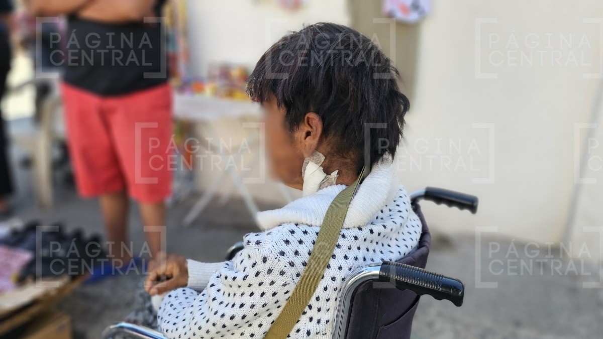 “¡Ay, ya me dieron!” Mujer herida por disparo accidental de GN dice que elementos huyeron