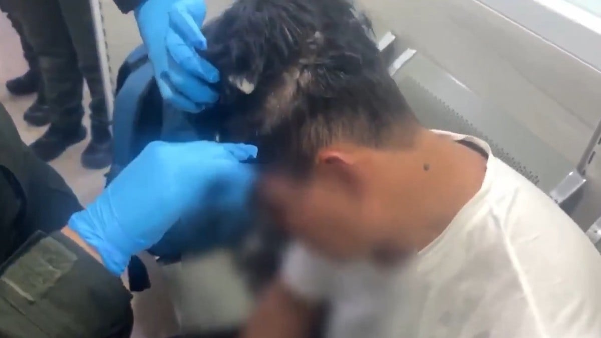 ¡Narco peluca! Así encontraron cocaína en la cabeza de un pasajero en aeropuerto