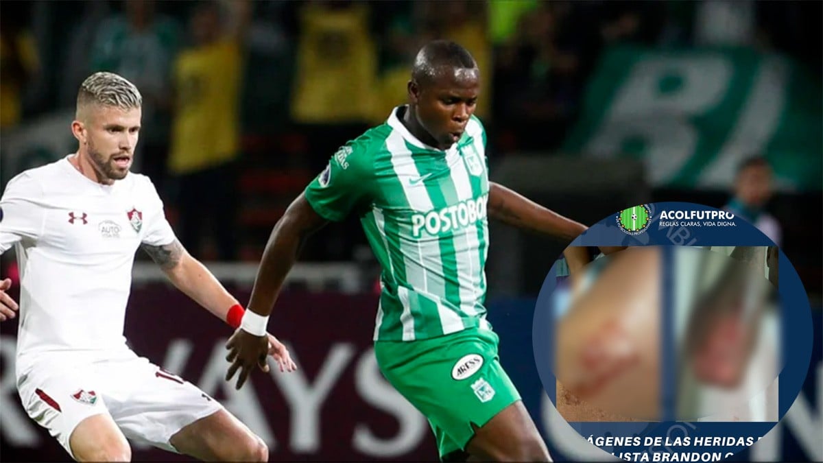 Futbolista es apuñalado por seguidores de su equipo, presuntamente por malos resultados