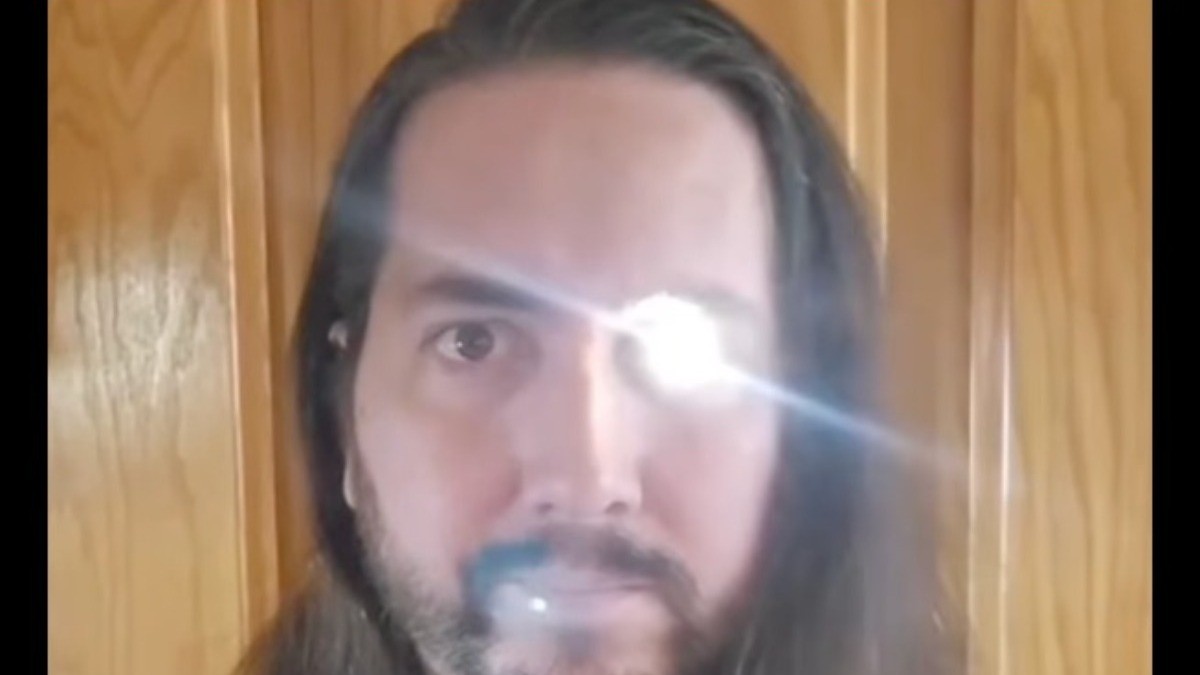 VIDEO Perdió un ojo por cáncer y ¿lo sustituyó por uno biónico?