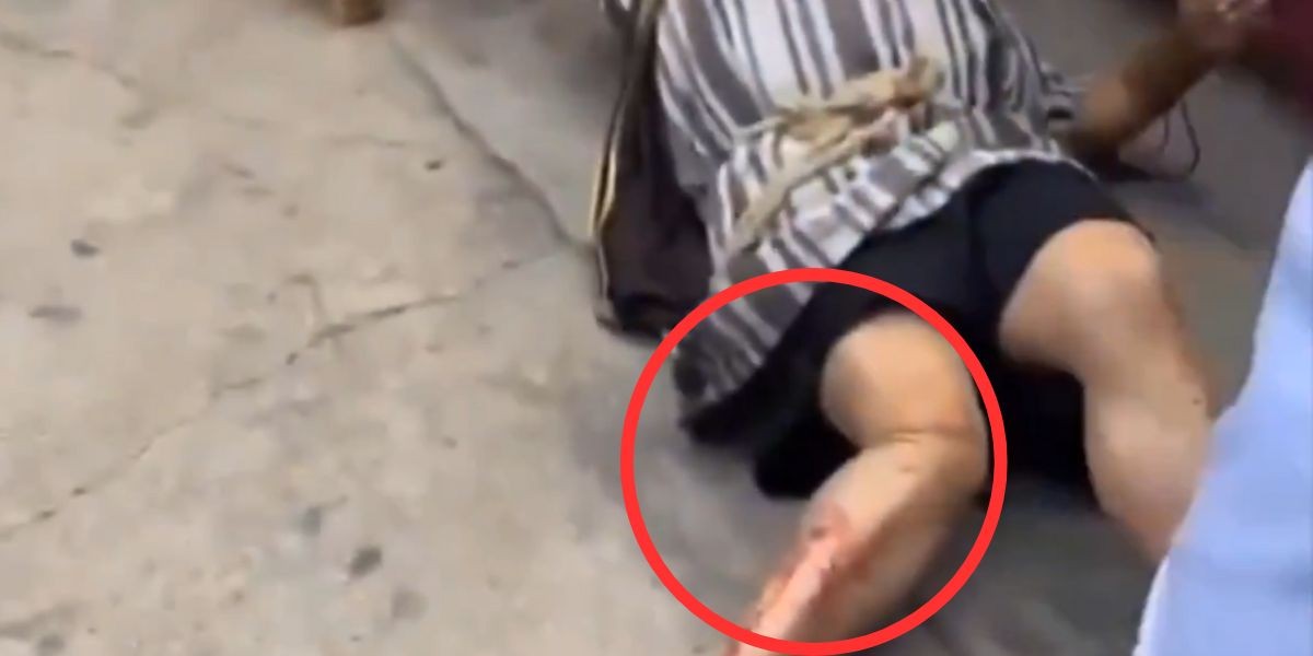 VIDEO ‘Soy libre’, actor que interpretó a ‘Barrabás’ en Viacrucis se rompe la pierna