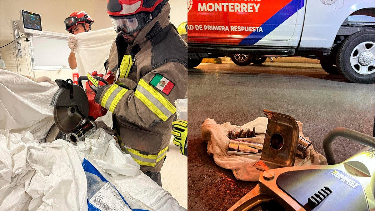 Bebé pierde la mano izquierda tras quedar atrapado en una máquina moledora de carne