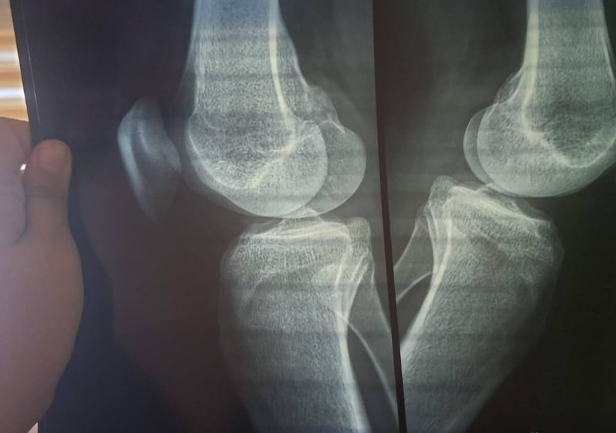 ¡Madre clama justicia! Denuncia que policías golpearon a su hijo dejándole lesión cervical