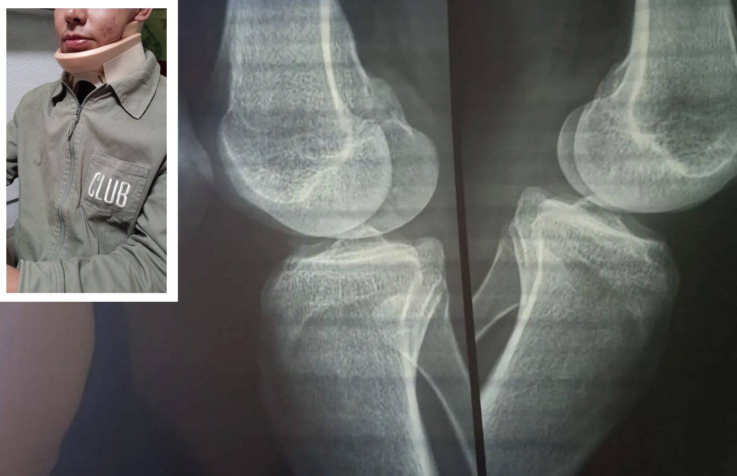 Fiscalía estatal y Prodheg ya investigan presunto abuso policial contra menor en Las Joyas