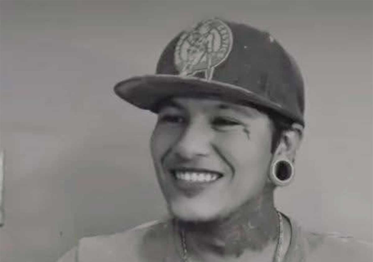 VIDEO “Se le empezó a inflamar el cuello” Joven muere luego de una infección en las muelas