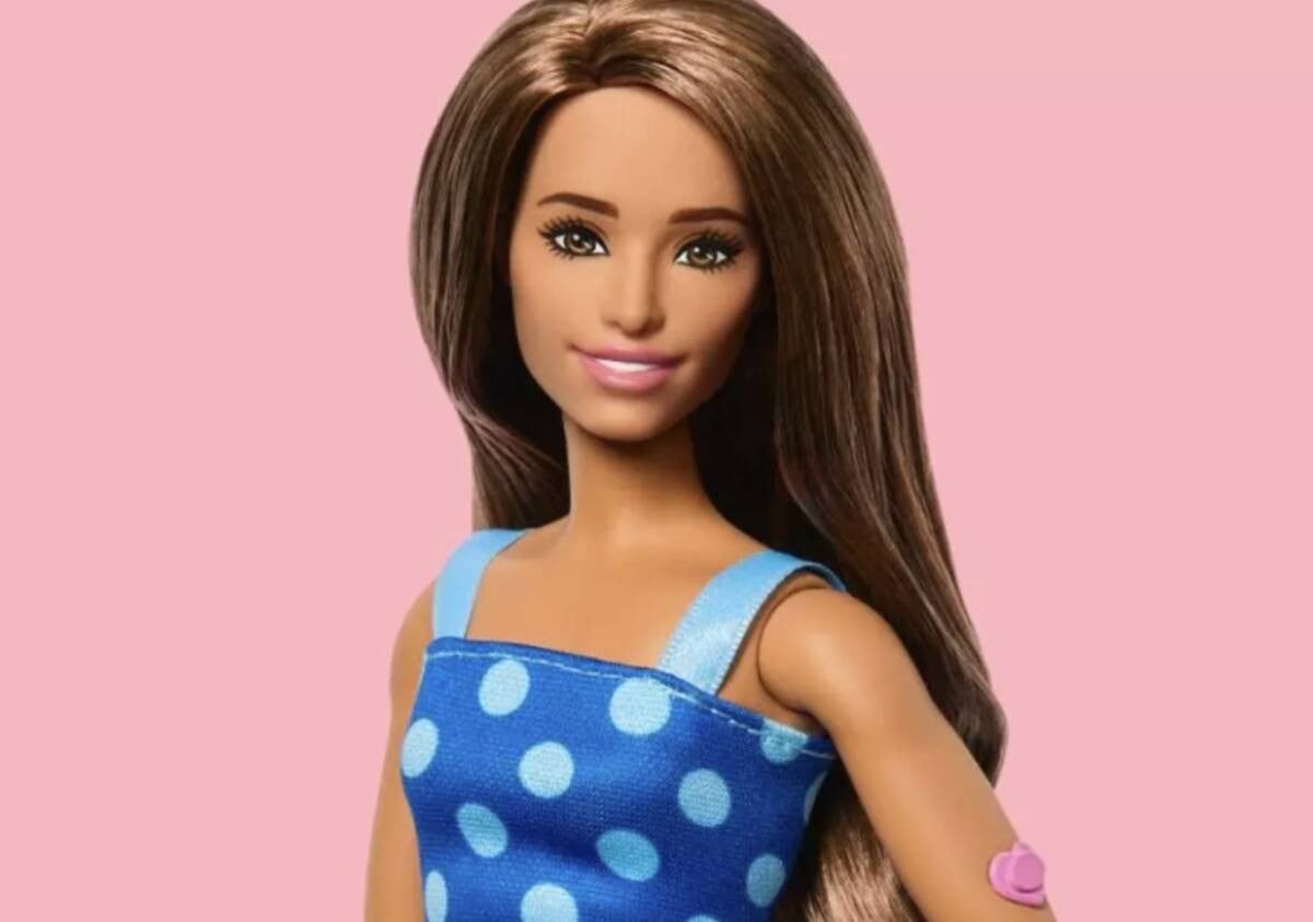 ¿Sabías que hay una Barbie con diabetes? Trae estos accesorios