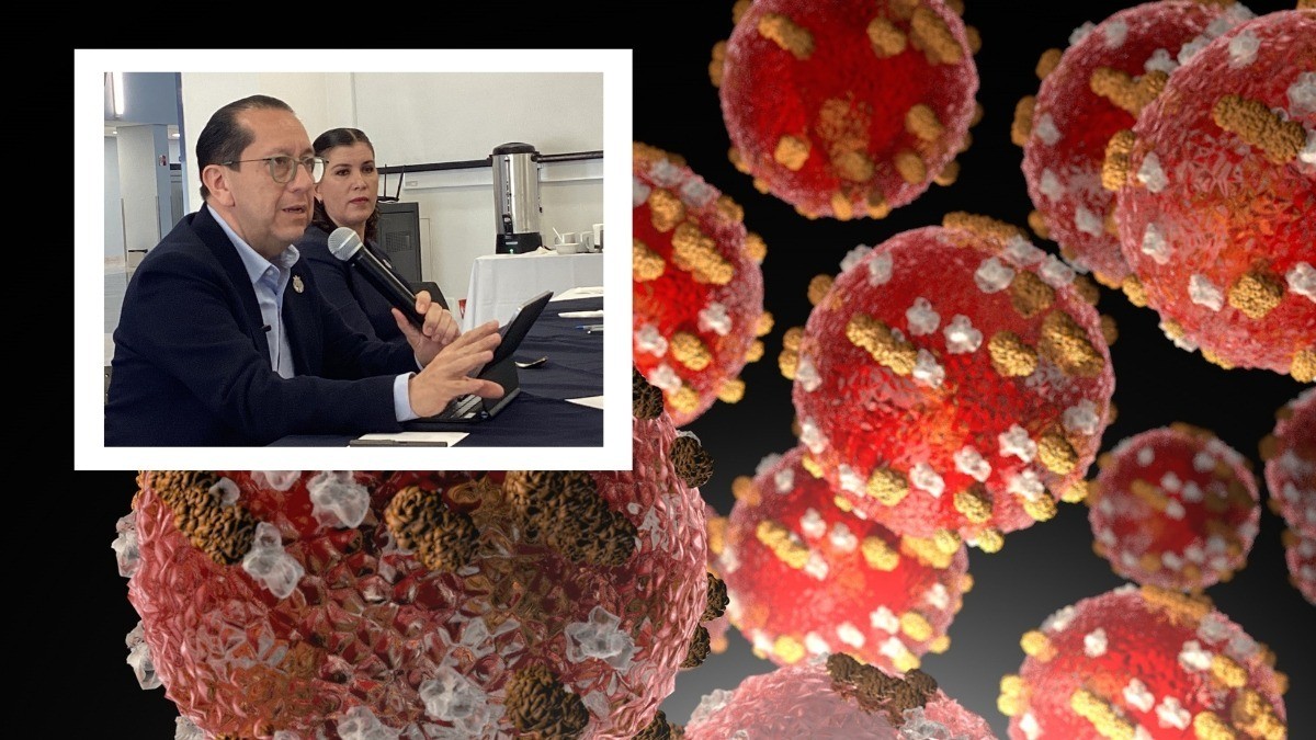 ¡Ten cuidado! Guanajuato suma otro caso de sarampión, ahora en una niña leonesa