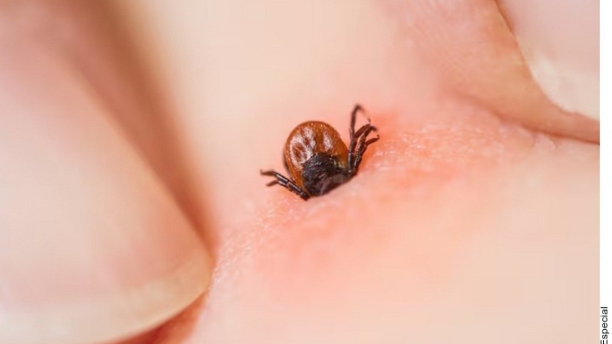¡Cuídate de las picaduras de garrapatas!