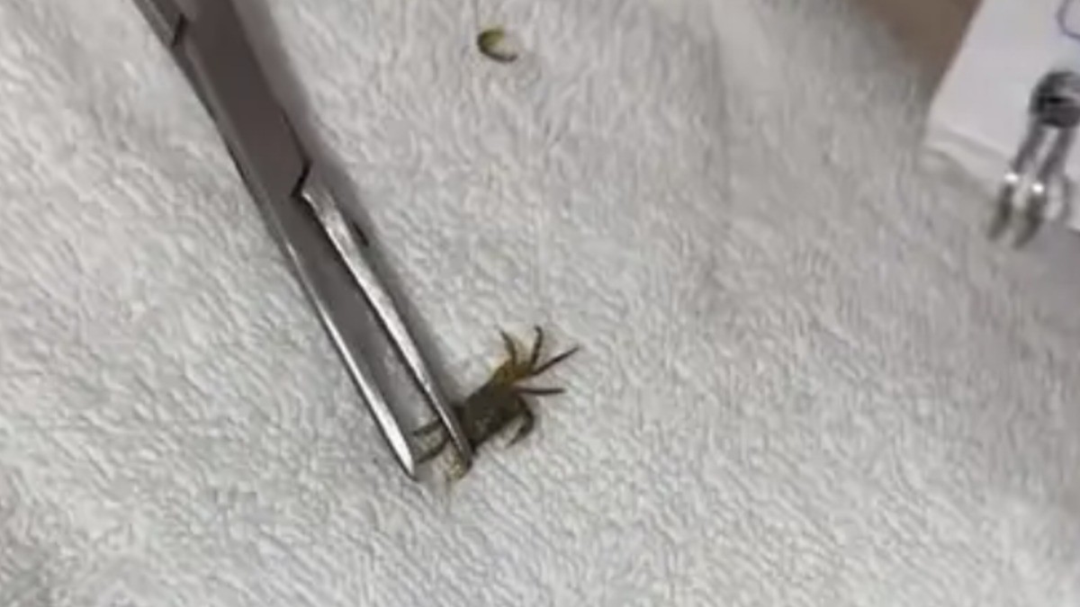 VIDEO ¿Pero cómo llegó ahí? Niño termina en hospital por traer ¡un cangrejo en la oreja!