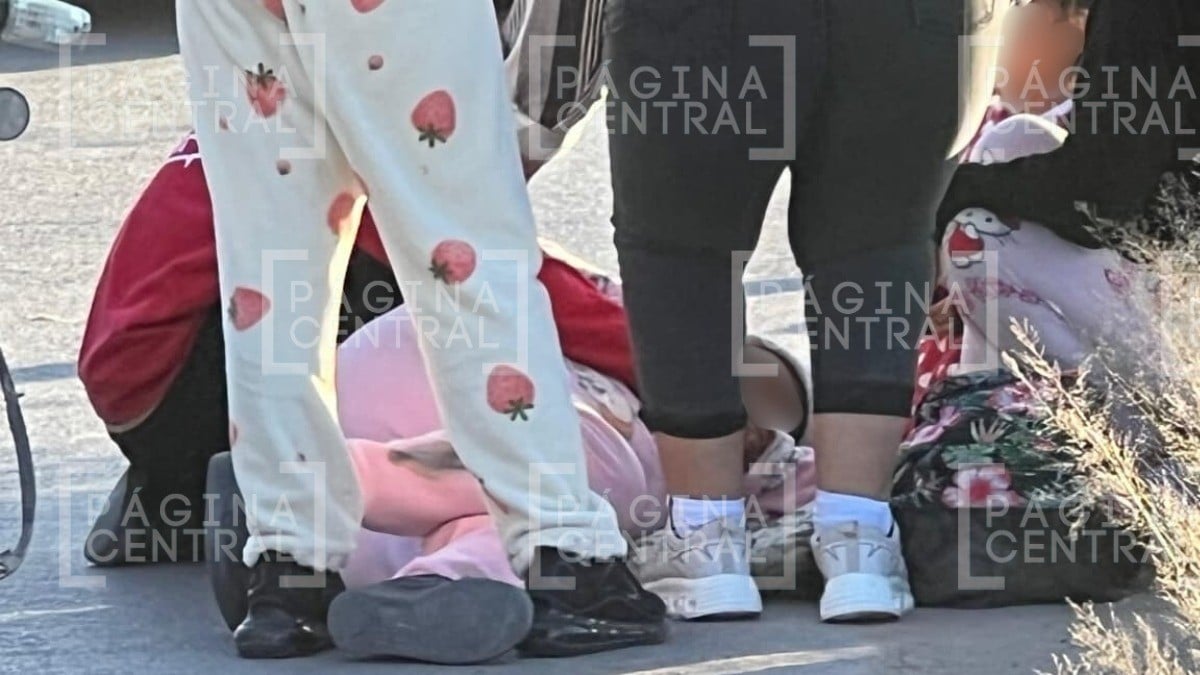 Papá, hija y mamá embarazada viajaban en una moto y derraparon, ¡ella está grave!