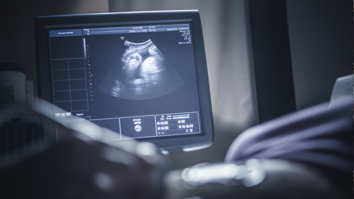 Mujer se entera de que está embarazada nueve bebés; médicos alertan por su estado de salud