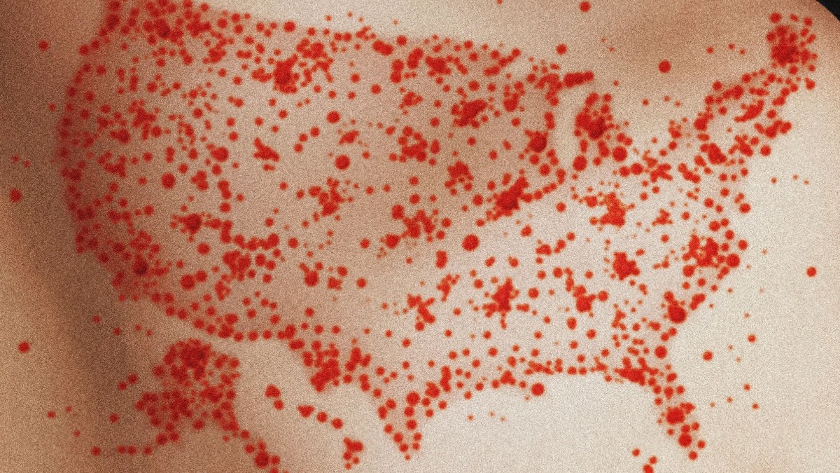 ¿Se viene pandemia? Repuntan casos de sarampión ahora en Estados Unidos