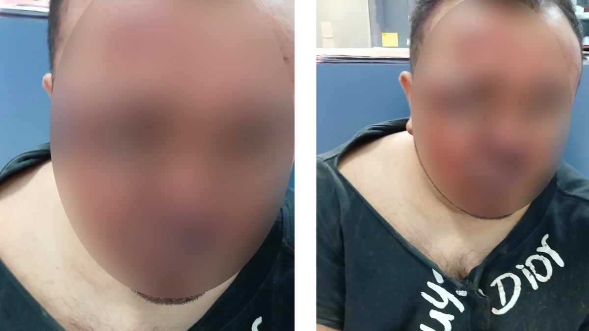 VIDEO Leonés denuncia abuso de autoridad: Hacía remodelación cuando fue detenido a golpes 