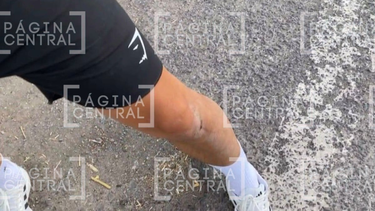 Agreden a reportero en Juventino Rosas