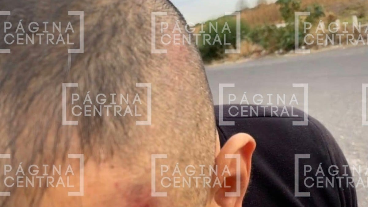 Agreden a reportero en Juventino Rosas