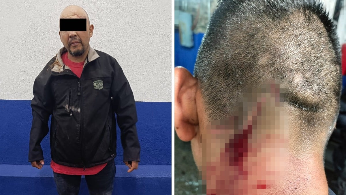 ¡Lo lesionó en la cabeza! Hombre agrede a policía con una navaja en Guanajuato capital