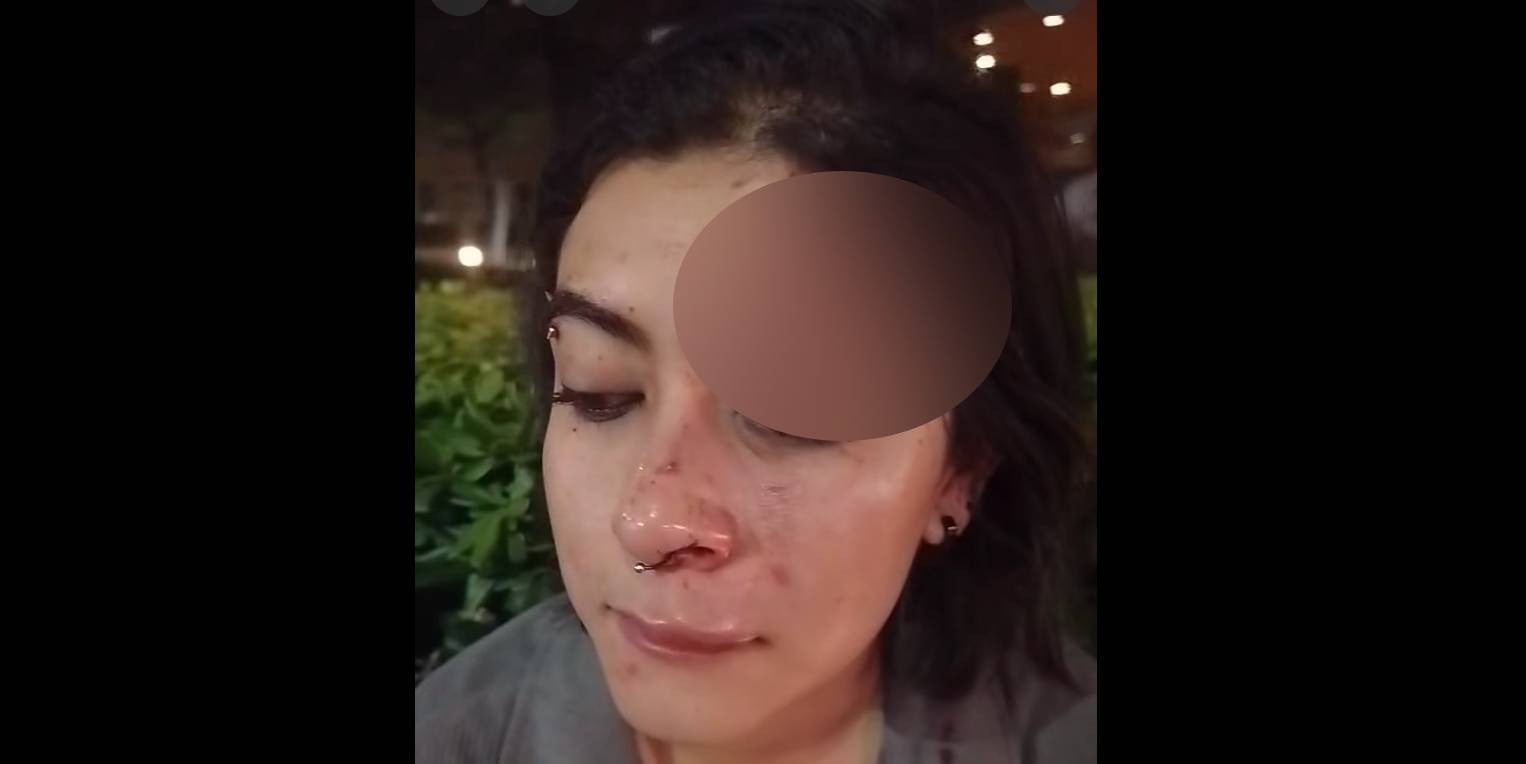 Reportan violento asalto en León: Sujeto habría golpeado con piedra a joven cerca del Forum