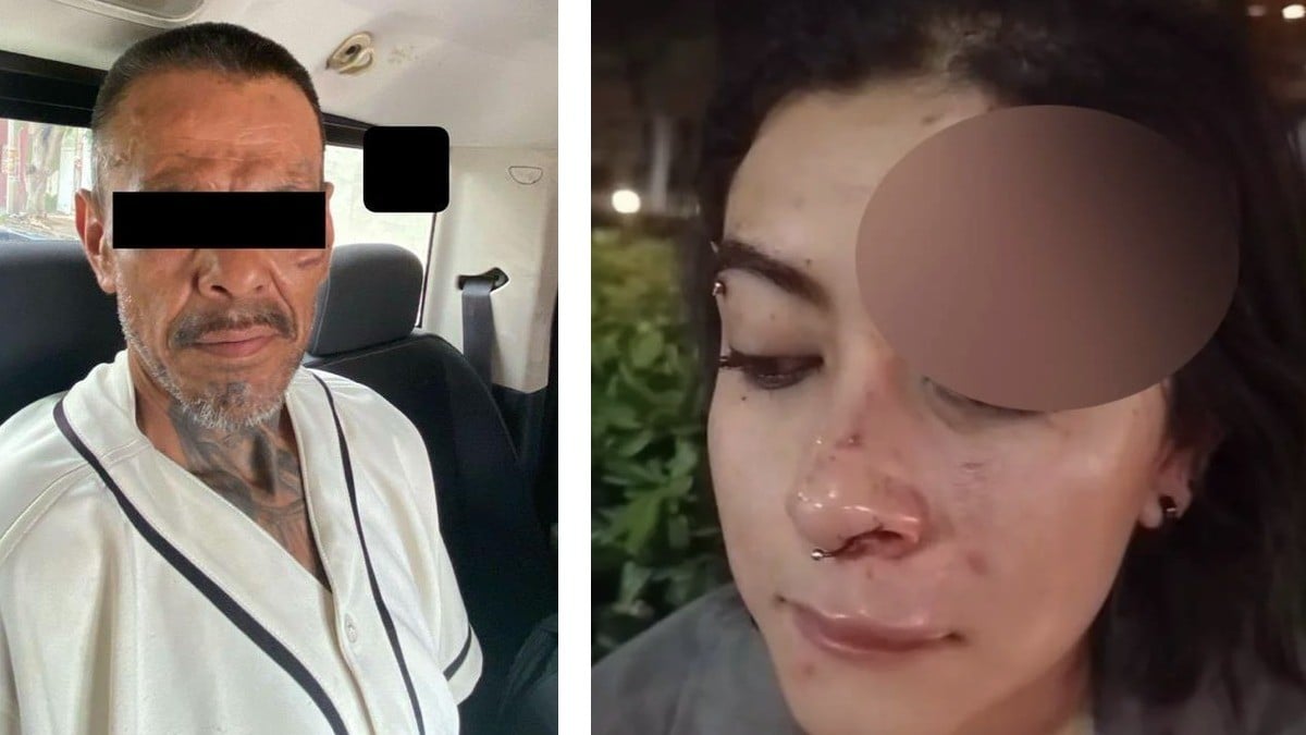Capturan al agresor de Verónica, joven golpeada con una piedra cerca del Forum