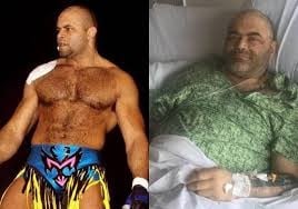 Amputan las dos piernas a Konnan