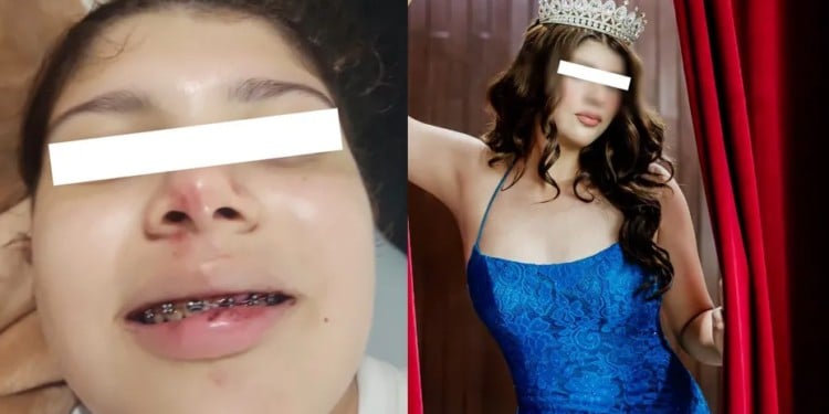 Muere Dafne en campamento de Tamaulipas