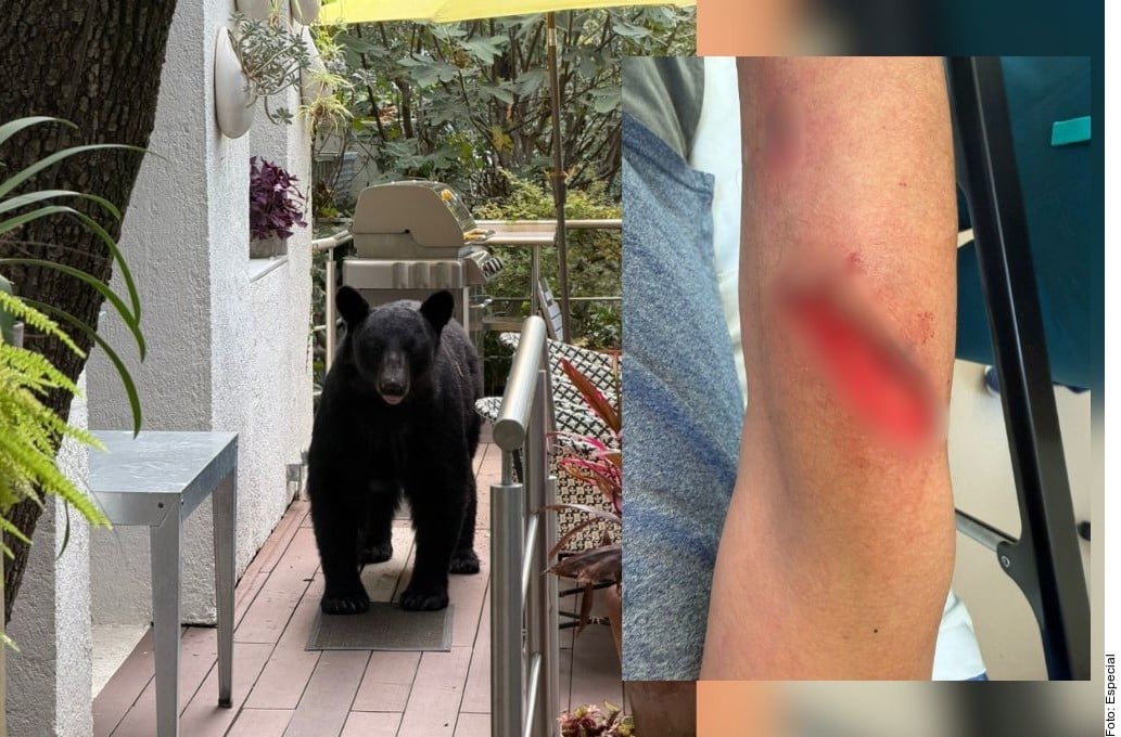 Oso ataca y hiere a uno en San Pedro
