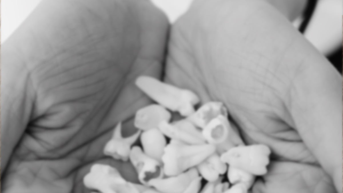 ¡Perturbador hallazgo! Miles de dientes de leche en fosa clandestina