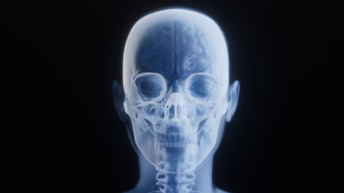 Bonesmashing