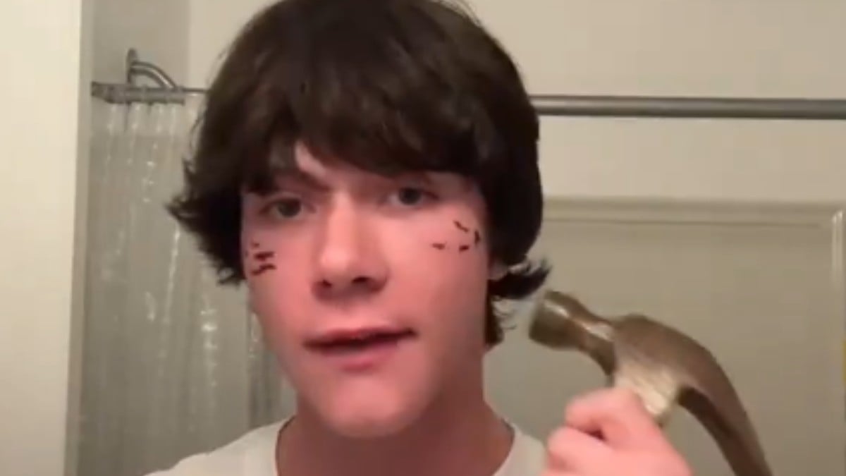 ¿Sabes qué es el bonesmashing? Alertan por tendencia de golpearte la cara para ser más guapo