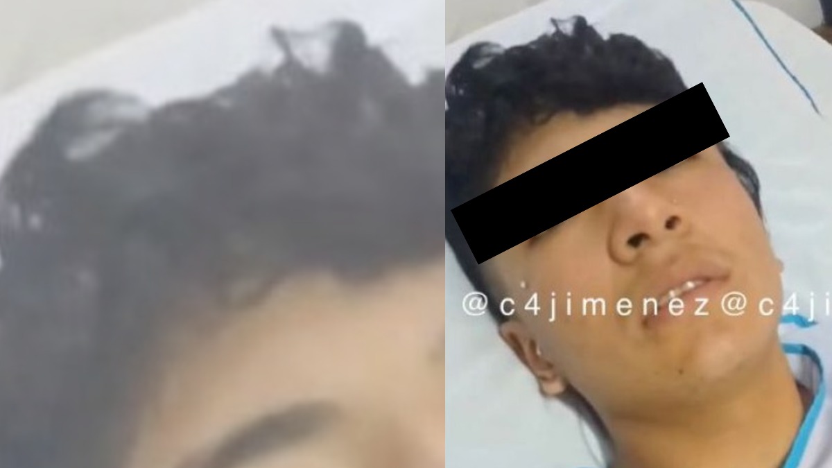 Estudiante quemado en escuela