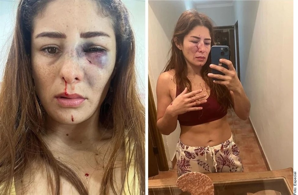 Luchadora sufre golpiza de su ex pareja
