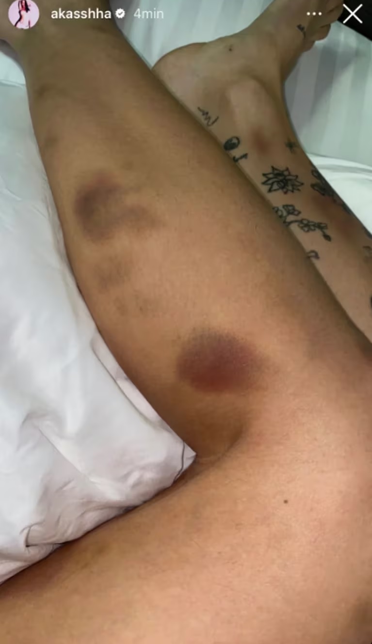 Alemán golpea a Akasha